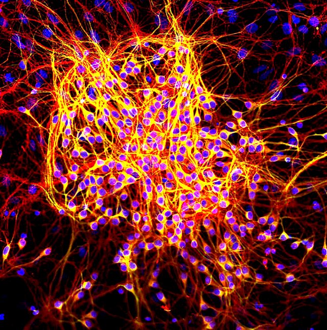 Neurons